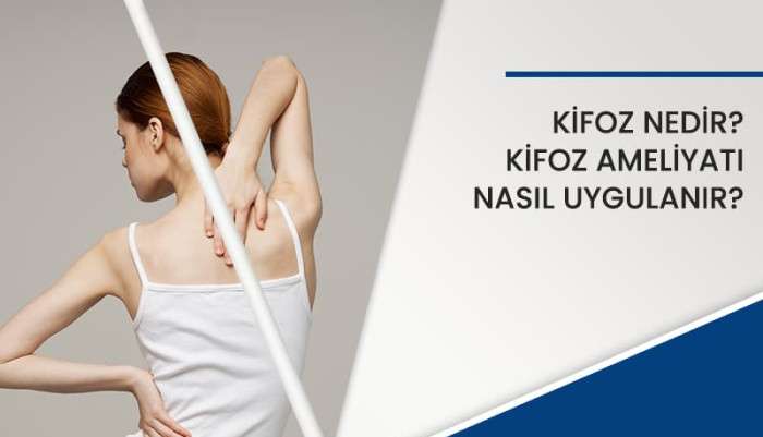 kifoz-nedir